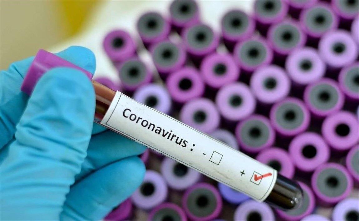  مشکوک به کروناویروس 