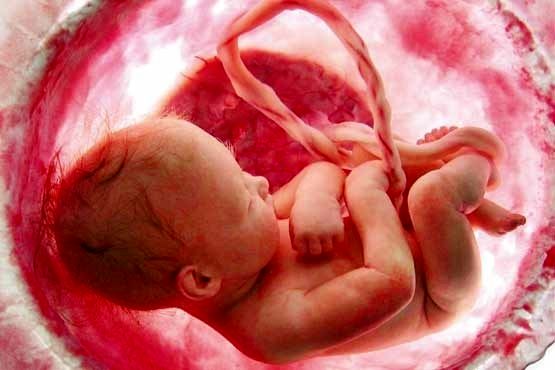 سقط غیرایمن از عوامل مهم مرگ زنان در دنیا