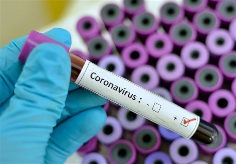چه کسانی باید آزمایش ویروس کرونا بدهند؟