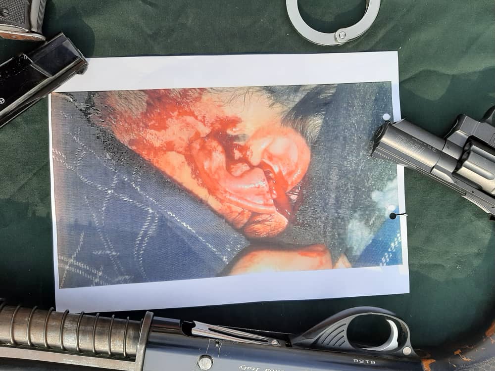 بازداشت چاقوکشی که پس از تصادف، گوش راننده مقابل را برید +عکس