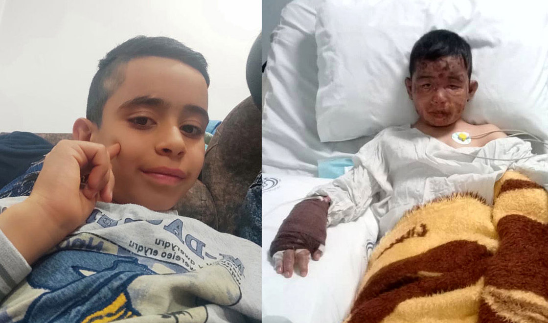 محمد طا‌ها ۹ ساله سوخت تا ۴ کودک زنده بمانند +فیلم