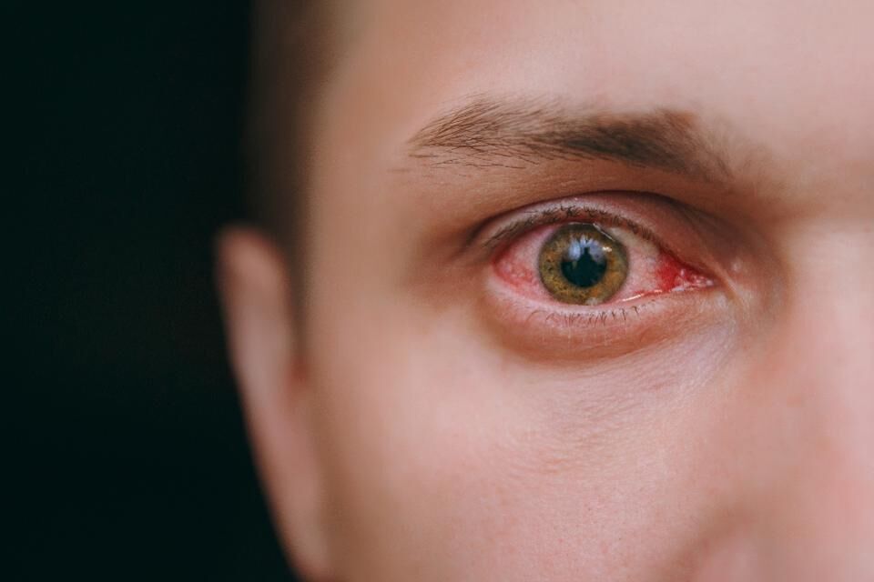 علائم بیماری‌های چشم