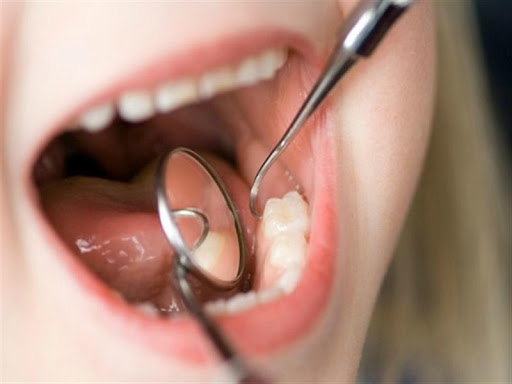 درمان خانگی پوسیدگی و خرابی دندان