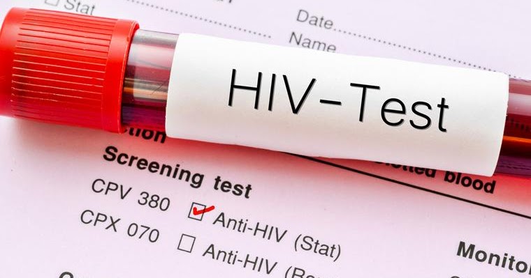تست رایگان HIV