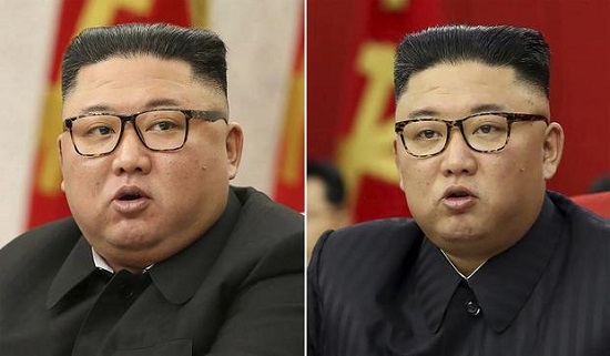 لاغری رهبر کره شمالی