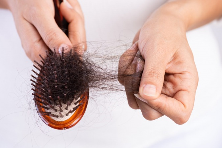 چطور موهای کاشت شده را پرپشت کنیم؟