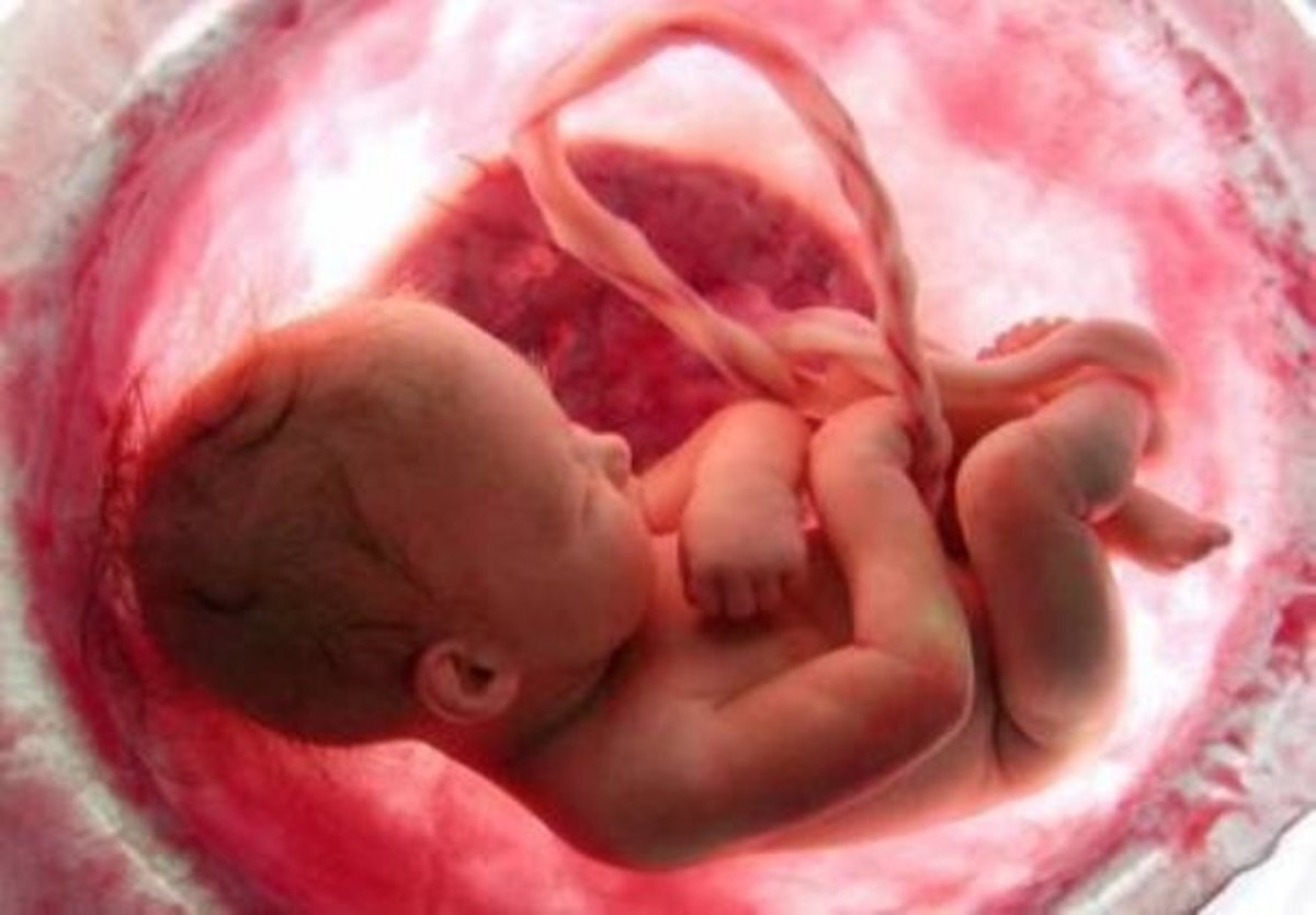 گشت مقابله با سقط جنین هم راه‌اندازی شد!